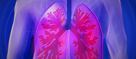 CyPath® Lung выявляет рецидив у пациента с раком лёгких в анамнезе