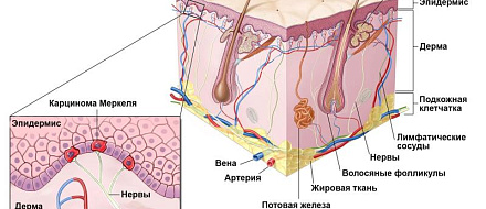 Иммунные клетки для борьбы с агрессивной клеточной карциномой Меркеля