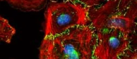 Биоактивный растворимый рекомбинантный мышиный белок LIGHT способствует эффективной инфильтрации иммунных клеток в опухоль